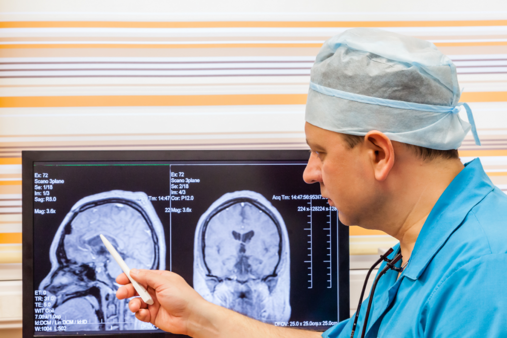 Indianapolis Brain Injury Attorney Indiana Personal